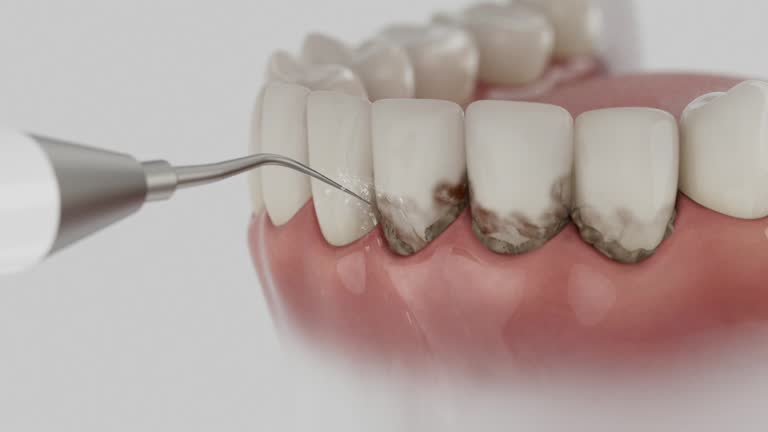 Trusted Tooth Extraction service in Ocilla, GA - Dentist Open Now